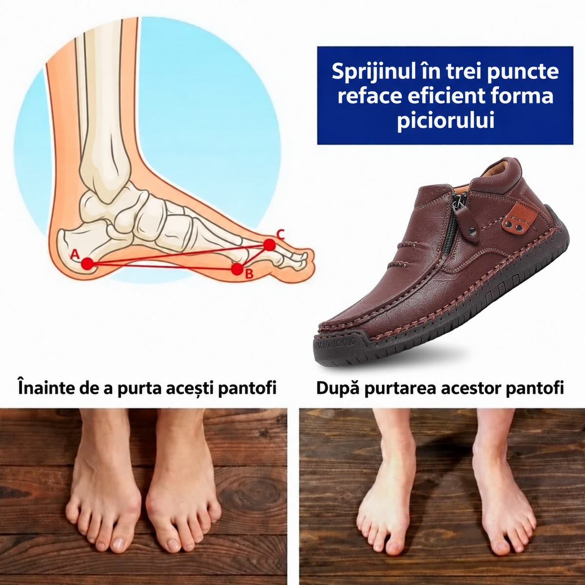 ⏰ Ofertă la jumătate de preț — Doar astăzi! 🔥 | Încălțăminte ortopedică din piele naturală de înaltă calitate | Susținere a boltei plantare pentru a calma durerea și a facilita mersul